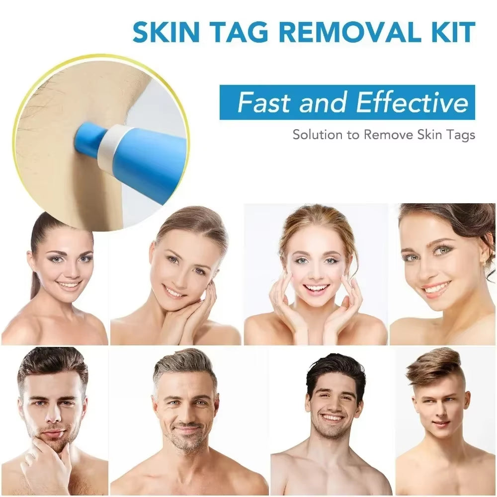 2-in-1 Painless Skin Tag & Wart Removal Kit - Effective Face & Body Treatment Tools for Flawless Skin